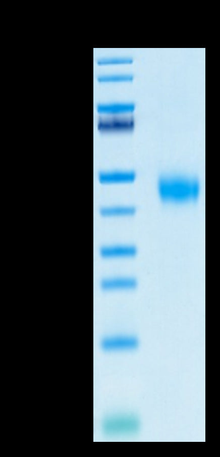 Biotinylated Human IL-2 R beta on Tris-Bis PAGE under reduced condition. The purity is greater than 95%.