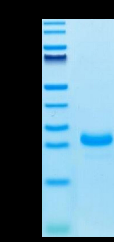 Cynomolgus IL-33 on Tris-Bis PAGE under reduced condition. The purity is greater than 95%.