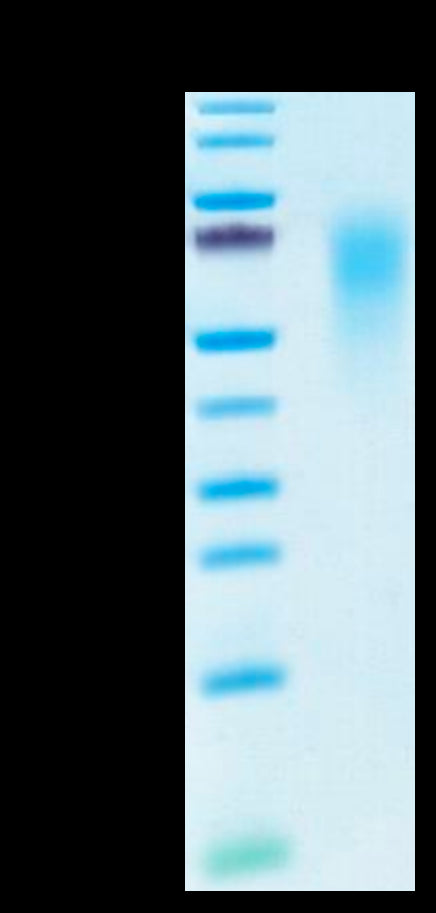 Human CEACAM-6 on Tris-Bis PAGE under reduced condition. The purity is greater than 95%.