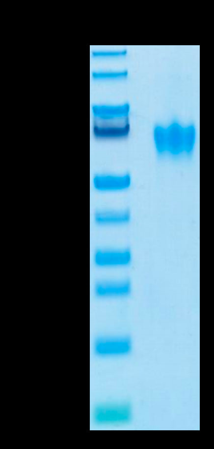 Biotinylated Human CEACAM-6 on Tris-Bis PAGE under reduced condition. The purity is greater than 95%.