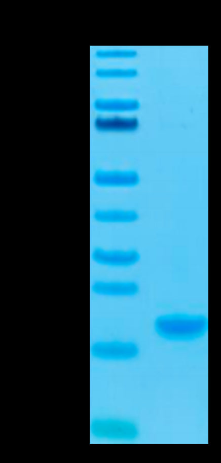 Human IL-7 on Tris-Bis PAGE under reduced condition. The purity is greater than 95%.