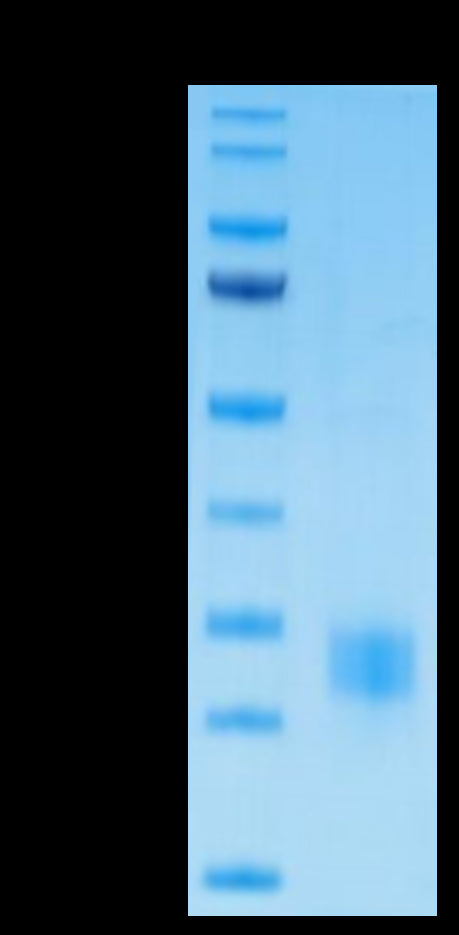 Biotinylated Human CTLA-4 on Tris-Bis PAGE under reduced condition. The purity is greater than 95%.