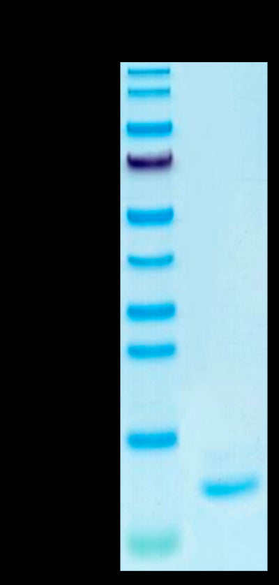 Human IL-15 on Tris-Bis PAGE under reduced condition. The purity is greater than 95%.