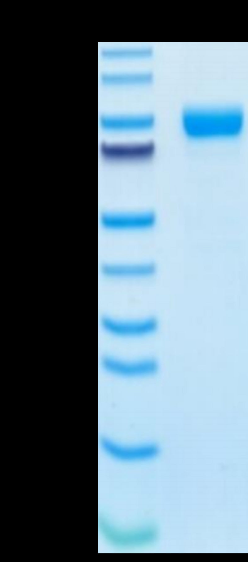 Human IL-1R3 on Tris-Bis PAGE under reduced condition. The purity is greater than 95%.