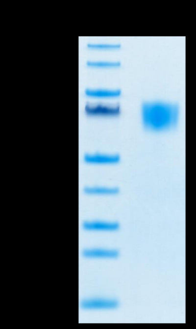 Biotinylated Human FGFR3 alpha- (IIIc) on Tris-Bis PAGE under reduced conditions. The purity is greater than 95%.