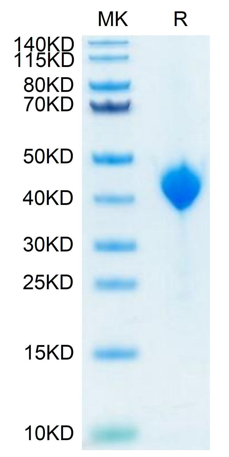 Cynomolgus Nectin-4 on Tris-Bis PAGE under reduced conditions. The purity is greater than 95%.