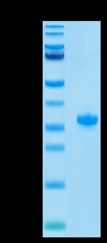 Human IgG4 Fc on Tris-Bis PAGE under reduced condition. The purity is greater than 95%.