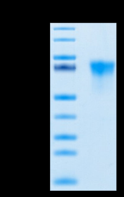 Human FGFR3 alpha (IIIb) on Tris-Bis PAGE under reduced conditions. The purity is greater than 95%.