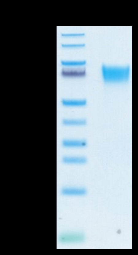 Biotinylated Human FGFR3 alpha (IIIb) on Tris-Bis PAGE under reduced conditions. The purity is greater than 95%.