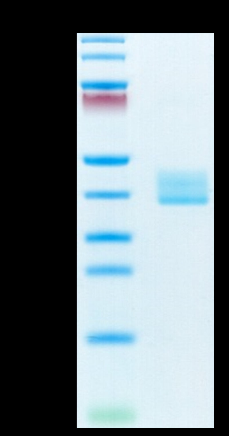 Mouse BCMA on Tris-Bis PAGE under reduced condition. The purity is greater than 95%.