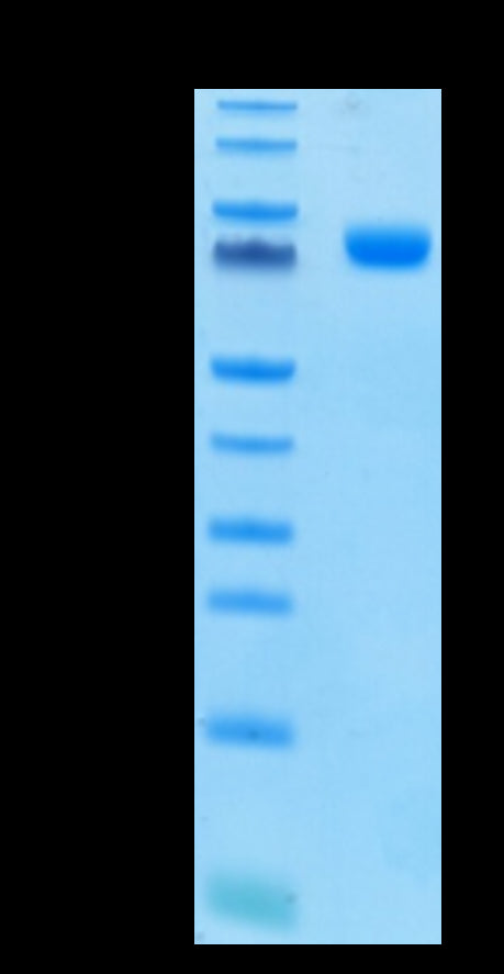 Human Siglec-3 on Tris-Bis PAGE under reduced conditions. The purity is greater than 95%.