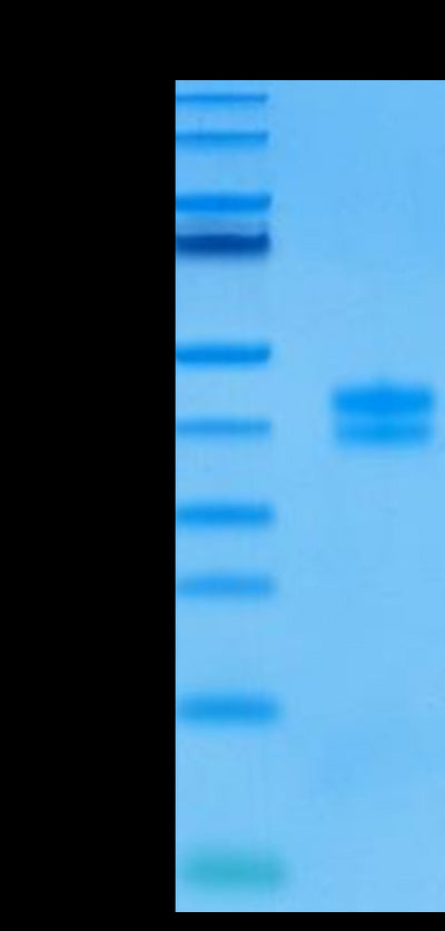 Human GPA33 on Tris-Bis PAGE under reduced condition. The purity is greater than 95%.