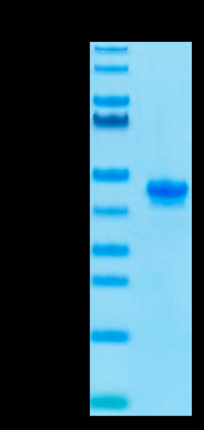 Mouse Nectin-4 on Tris-Bis PAGE under reduced conditions. The purity is greater than 95%.