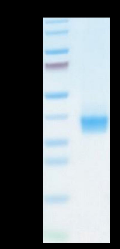 Biotinylated Cynomolgus/Rhesus macaque PD-L1 on Tris-Bis PAGE under reduced conditions. The purity is greater than 95%.