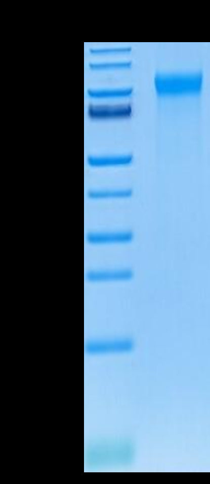 Human E-selectin on Tris-Bis PAGE under reduced condition. The purity is greater than 95%.