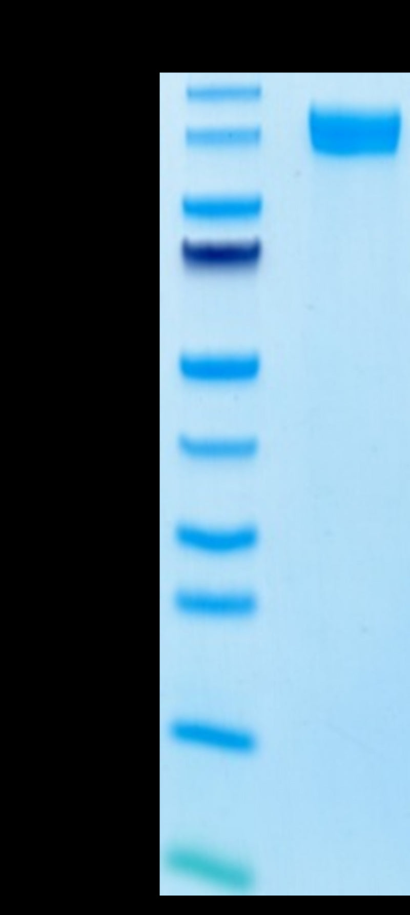 Human E-selectin on Tris-Bis PAGE under reduced conditions. The purity is greater than 95%.