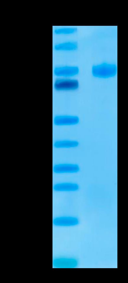 Human Endoglin on Tris-Bis PAGE under reduced conditions. The purity is greater than 95%.