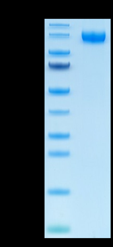 Human VEGF R1 on Tris-Bis PAGE under reduced condition. The purity is greater than 95%.