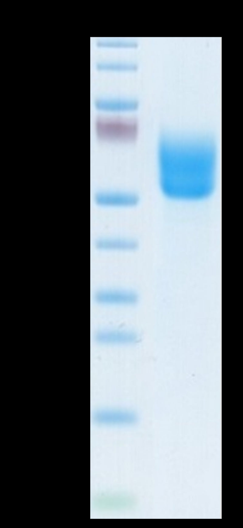 Biotinylated Human DKK3 on Tris-Bis PAGE under reduced conditions. The purity is greater than 95%.