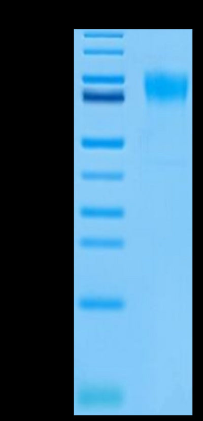 Biotinylated Human FGFR2 alpha (IIIb) on Tris-Bis PAGE under reduced conditions. The purity is greater than 95%.