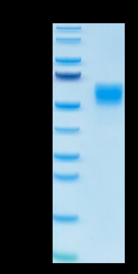 Human IL-13 on Tris-Bis PAGE under reduced condition. The purity is greater than 95%.