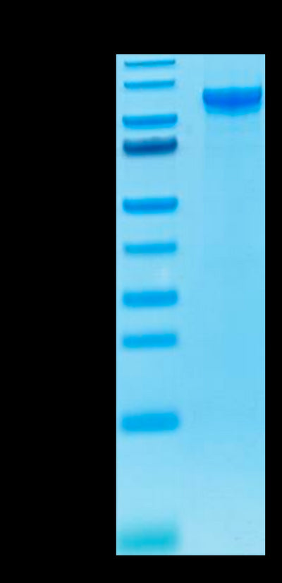 Human ENPP-2 on Tris-Bis PAGE under reduced condition. The purity is greater than 95%.