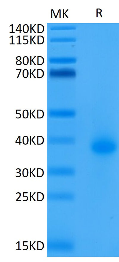 Biotinylated Human CD40 on Tris-Bis PAGE under reduced condition. The purity is greater than 95%.