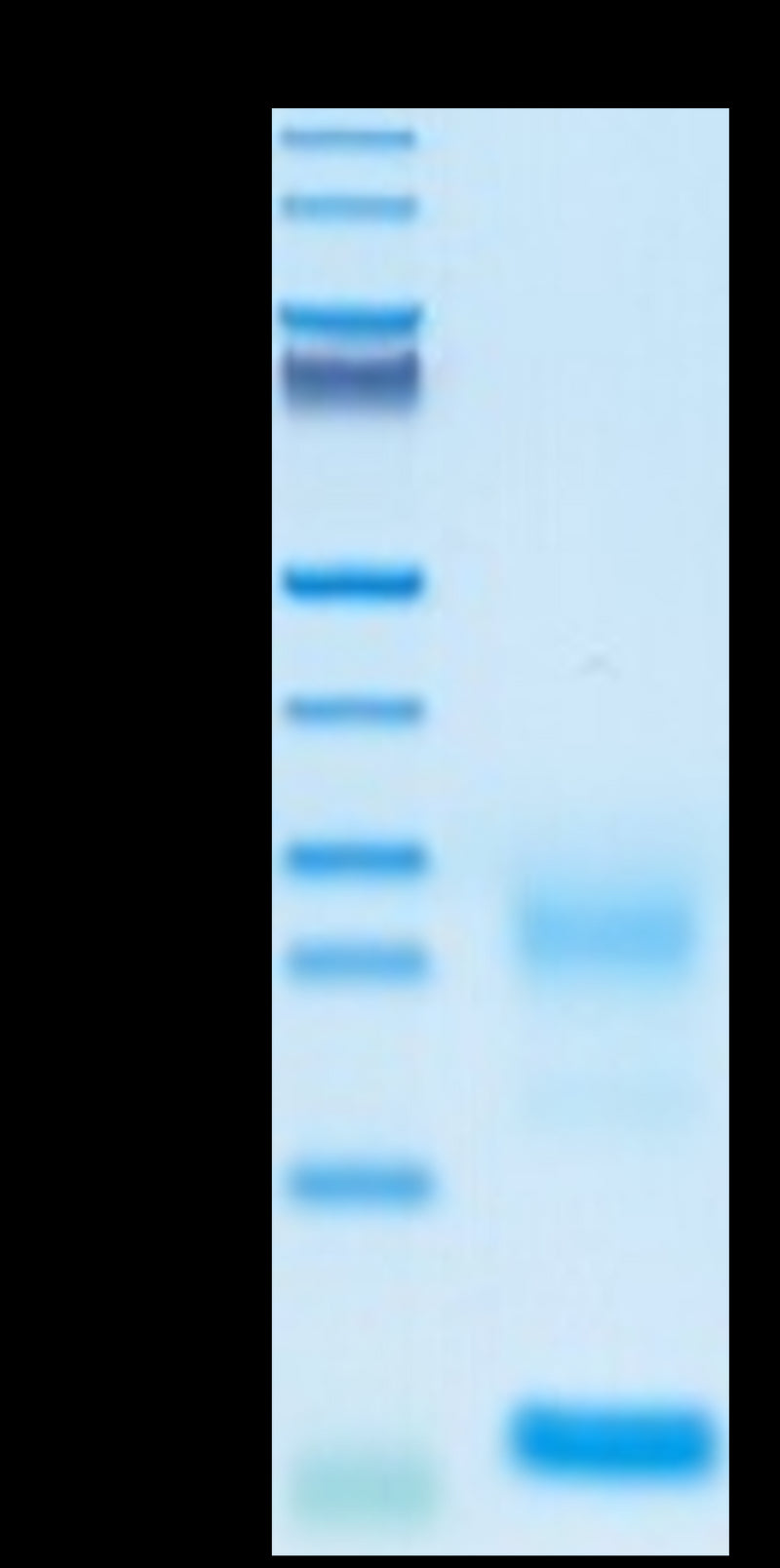 Biotinylated Human TSLP on Tris-Bis PAGE under reduced conditions. The purity is greater than 95%.