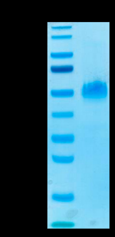 Human PVRIG on Tris-Bis PAGE under reduced condition. The purity is greater than 95%.