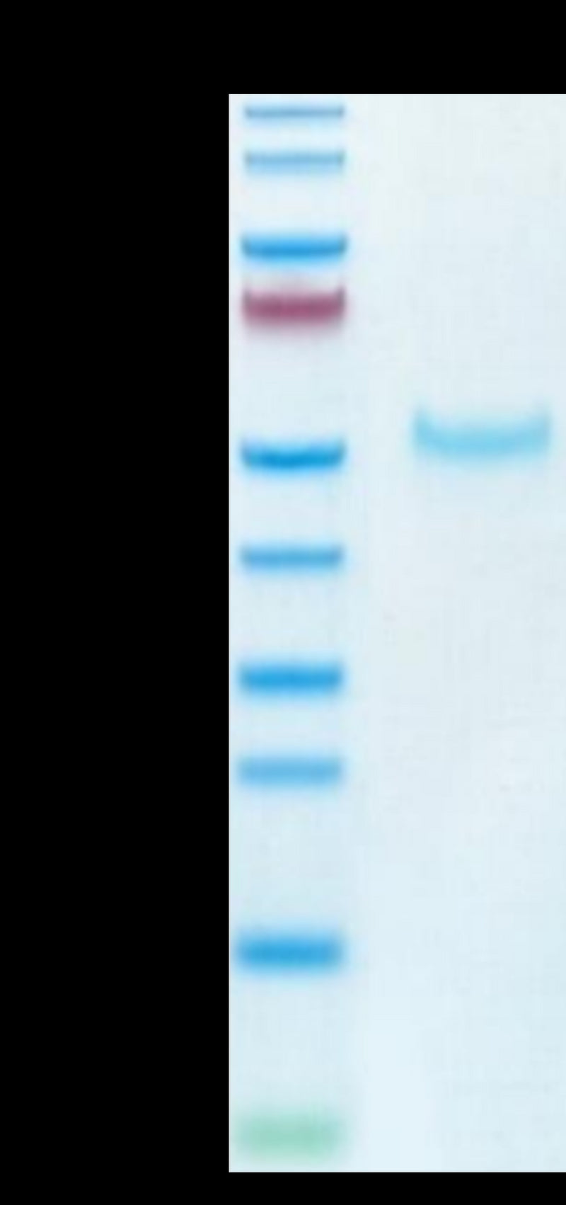 Cynomolgus PVRIG on Tris-Bis PAGE under reduced condition. The purity is greater than 95%.