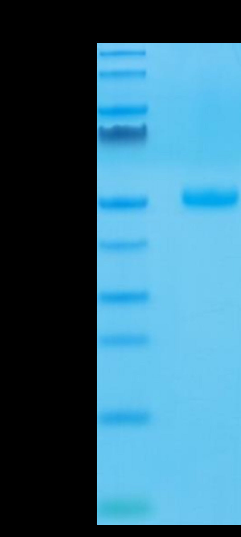 Human CTLA-4 on Tris-Bis PAGE under reduced condition. The purity is greater than 95%.