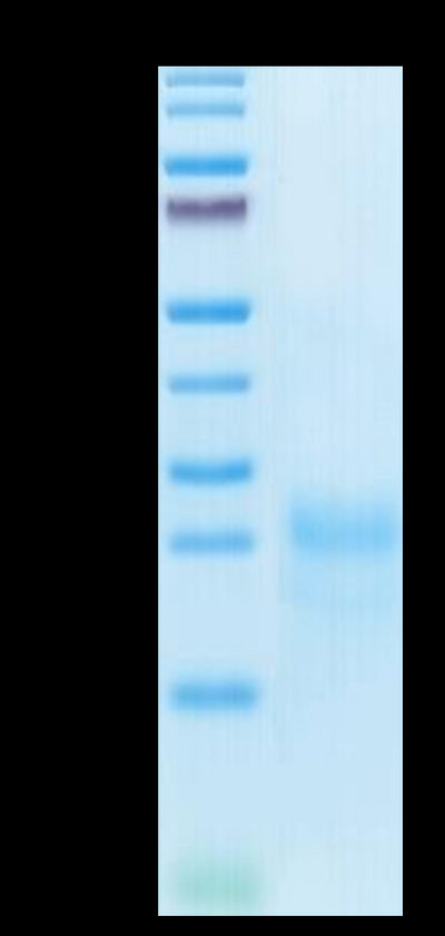 Cynomolgus CTLA-4 on Tris-Bis PAGE under reduced condition. The purity is greater than 95%.