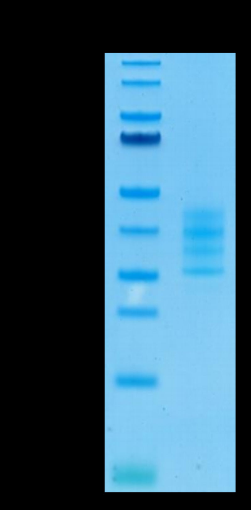 Human BCMA Trimer on Tris-Bis PAGE under reduced condition. The purity is greater than 95%.