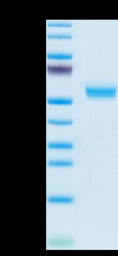 Cynomolgus BAFF Trimer on Tris-Bis PAGE under reduced condition. The purity is greater than 95%.