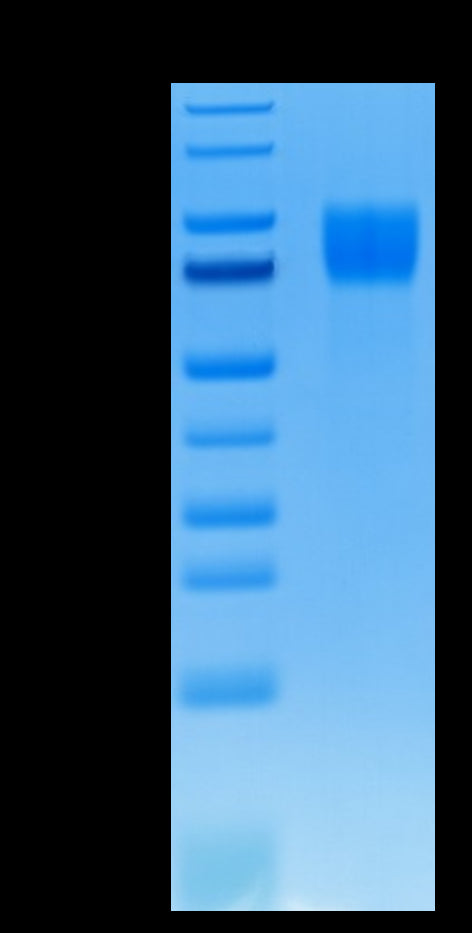 Human FGFR1 alpha (IIIc) on Tris-Bis PAGE under reduced conditions. The purity is greater than 95%.