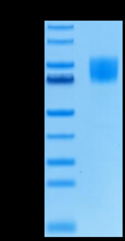 Biotinylated Human FGFR1 alpha (IIIc) -on Tris-Bis PAGE under reduced condition. The purity is greater than 95%.