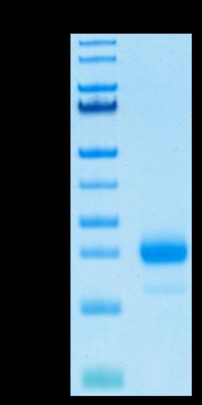 Human IL-4 on Tris-Bis PAGE under reduced condition. The purity is greater than 95%.