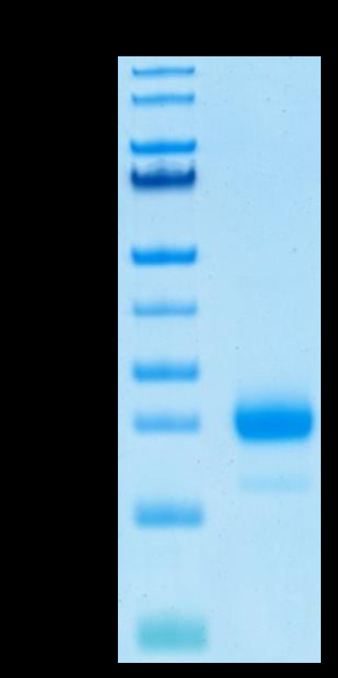 Human IL-4 on Tris-Bis PAGE under reduced condition. The purity is greater than 95%.