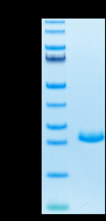 Mouse FGF21 on Tris-Bis PAGE under reduced condition. The purity is greater than 95%.