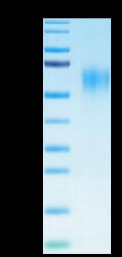 Human IL-15RA on Tris-Bis PAGE under reduced condition. The purity is greater than 95%.