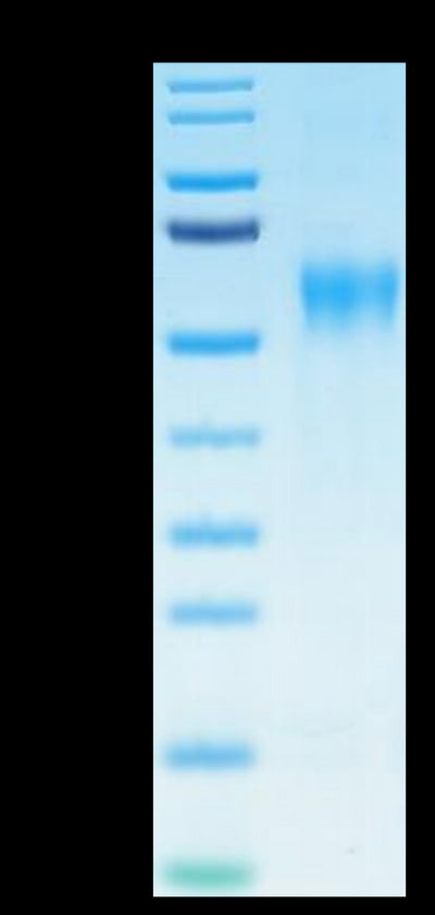 Biotinylated Human IL-15RA on Tris-Bis PAGE under reduced condition. The purity is greater than 95%.