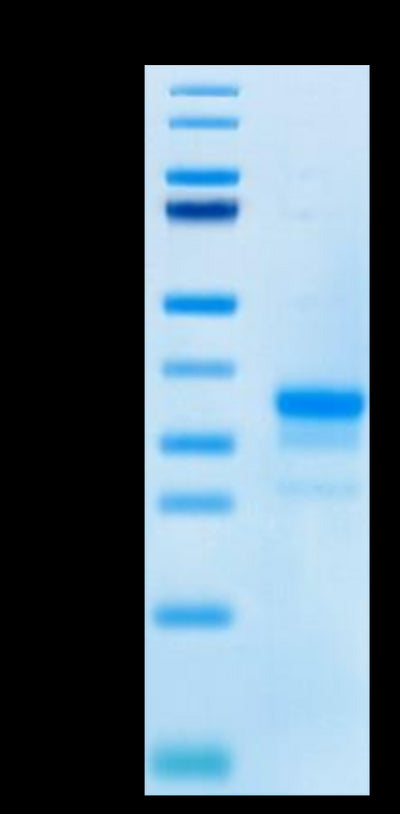 Cynomolgus CD40 on Tris-Bis PAGE under reduced condition. The purity is greater than 95%.