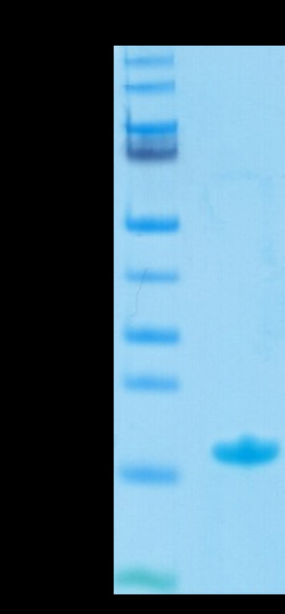 Biotinylated Human Nectin-4 IgV Domain on Tris-Bis PAGE under reduced condition. The purity is greater than 95%.