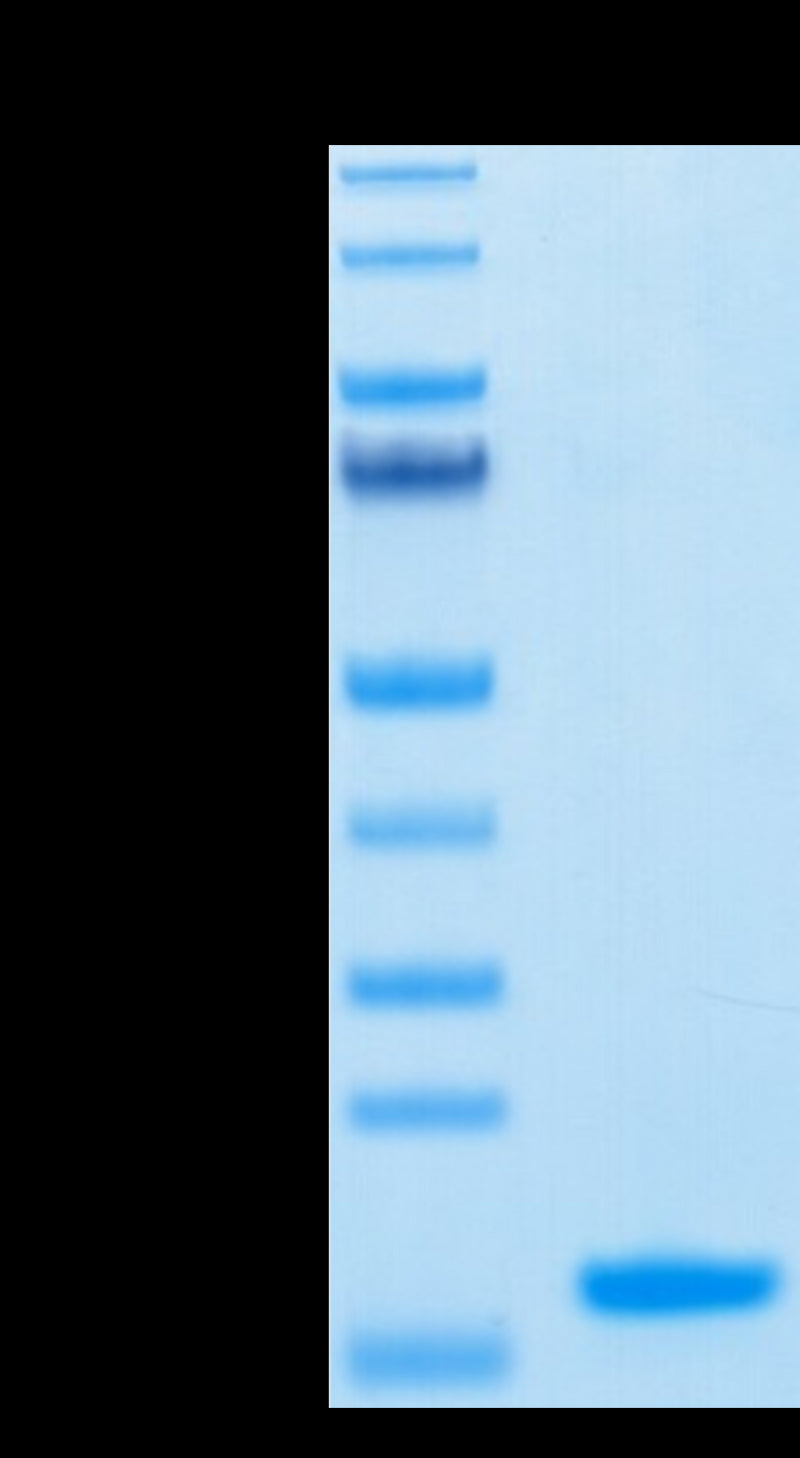 Human Nectin-4 IgV Domain on Tris-Bis PAGE under reduced condition. The purity is greater than 95%.