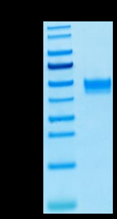 Human FGFR3 beta (IIIb) on Tris-Bis PAGE under reduced condition. The purity is greater than 95%.