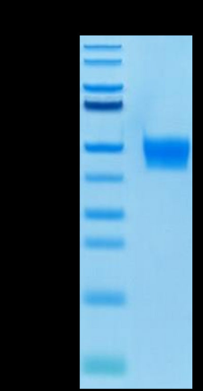 Biotinylated Human FGFR3 beta (IIIb) on Tris-Bis PAGE under reduced condition. The purity is greater than 95%.