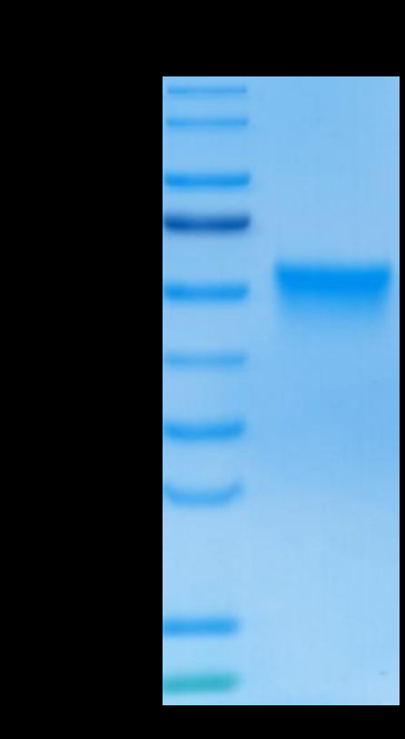 Human FGFR3 beta (IIIc) on Tris-Bis PAGE under reduced conditions. The purity is greater than 95%.