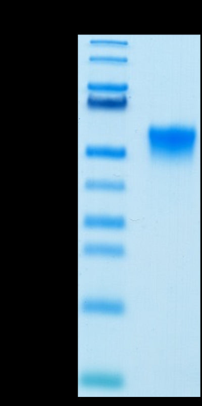 Biotinylated Human FGFR3 beta (IIIc) on Tris-Bis PAGE under reduced condition. The purity is greater than 95%.