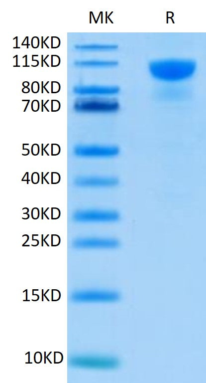 Human FGFR2 alpha (IIIb) on Tris-Bis PAGE under reduced condition. The purity is greater than 95%.