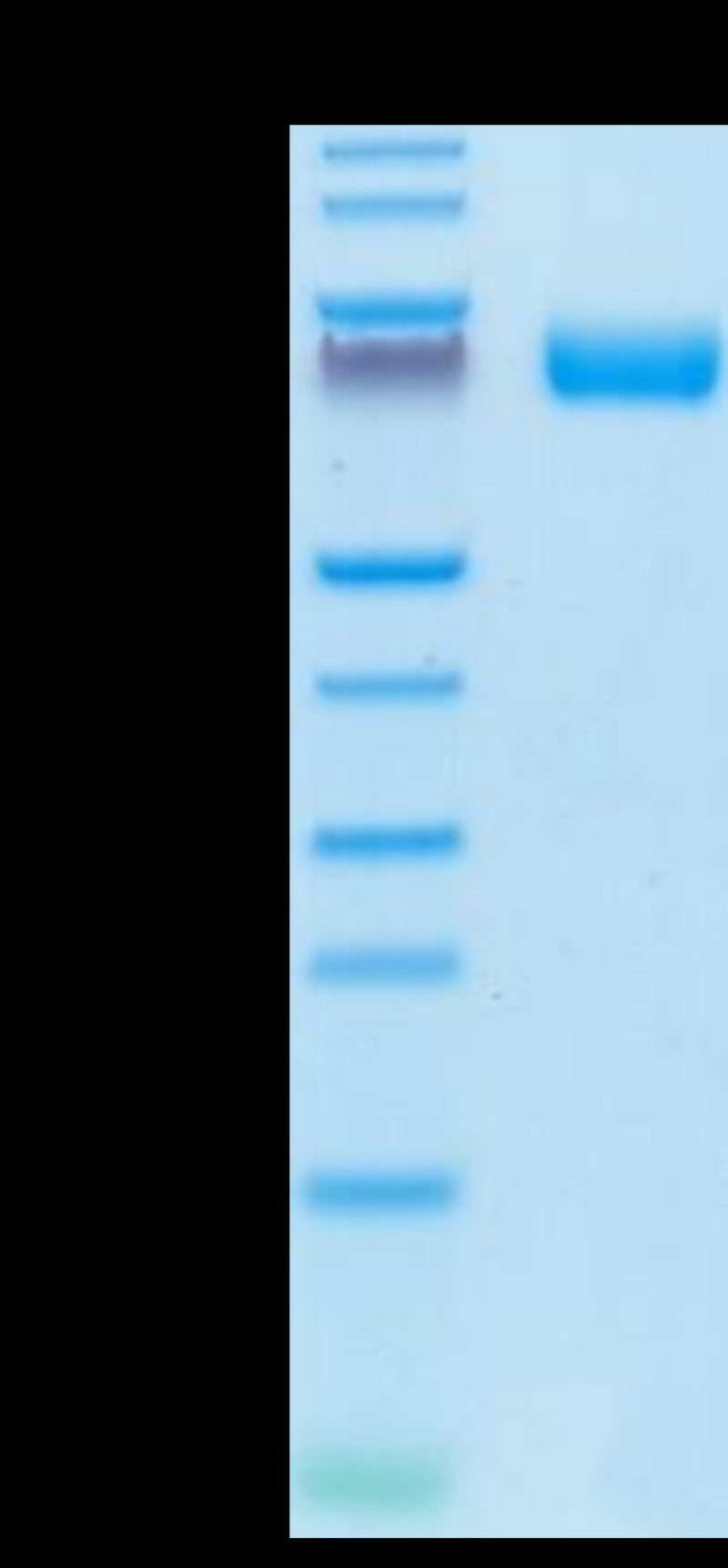 Human FGFR2 beta (IIIb) on Tris-Bis PAGE under reduced conditions. The purity is greater than 95%.